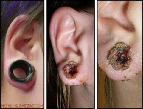 1 - Veja o que que piercings e alargadores podem fazer com você