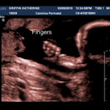 2010_03 Ultrasound 1.jpg