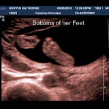 2010_03 Ultrasound 3.jpg