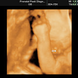 BABY_3.JPG