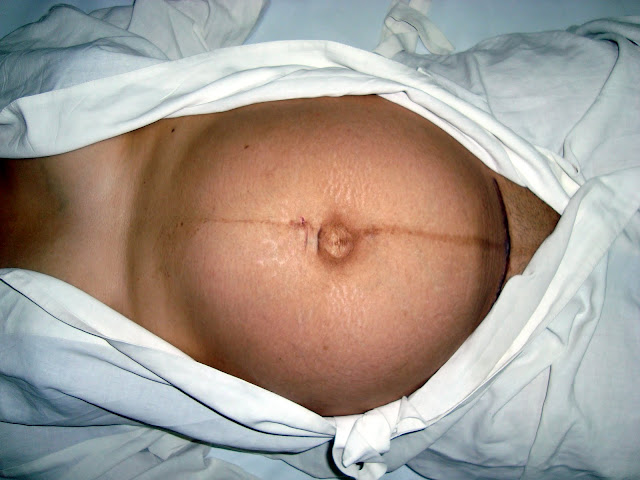 Last moments in the belly