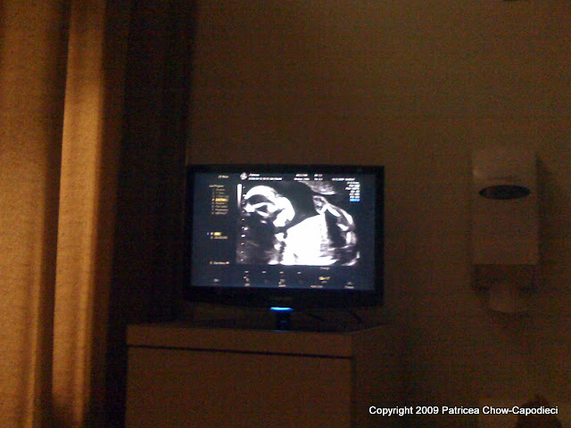 Ultrasound on screen