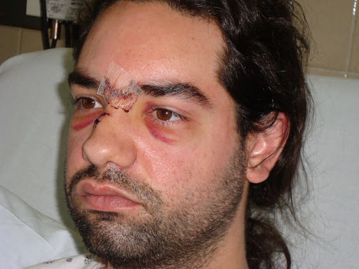 преимущественно преимущества