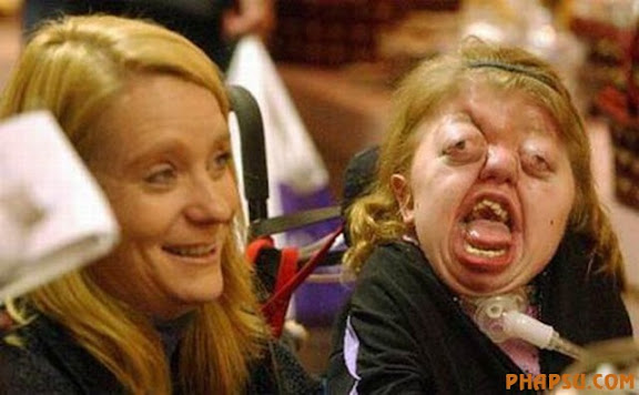 deformities_20.jpg?imgmax=576