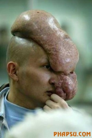 deformities_23.jpg?imgmax=576