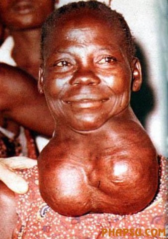 deformities_26.jpg?imgmax=576