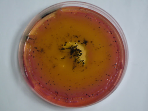 salmonella shigella petri dish
