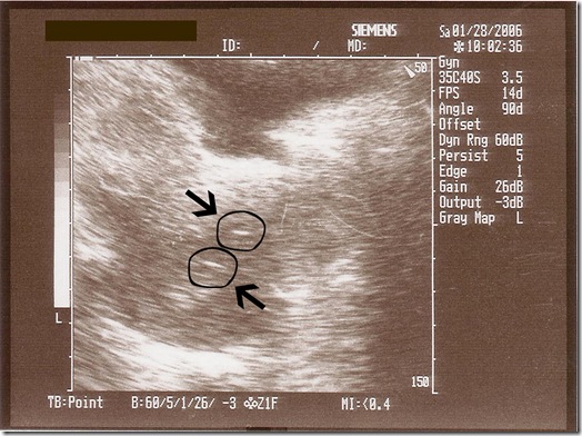 implantation day