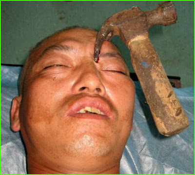 Hammer head