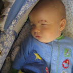 Surgery- Post-Op Snooze.JPG