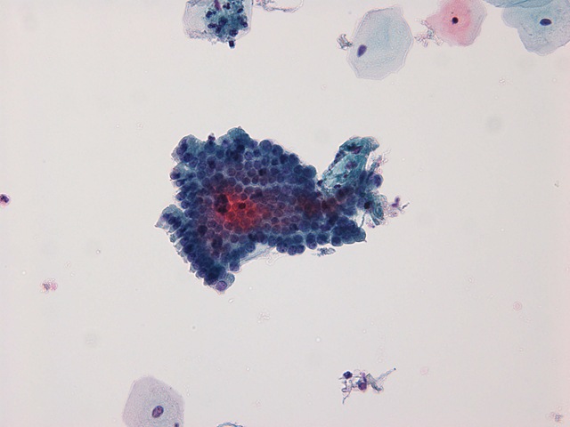 [Endocervical Cells - 20x[2].jpg]