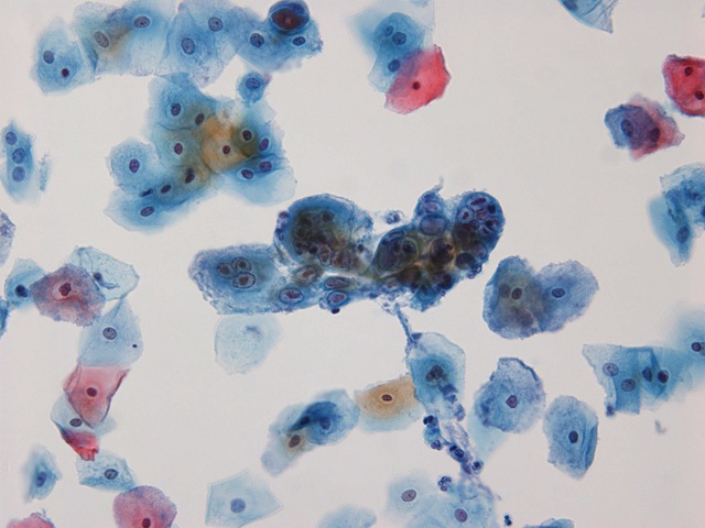 [Herper Simplex Virus - 20x[2].jpg]