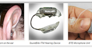 SoundBite™ Hearing System Gets European CE Mark-Wireless Hearing Aid That Attaches to Your Teeth ...