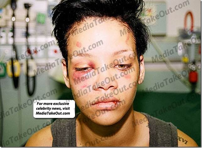 1298558182rihanna_abuse1