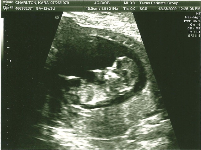 [sonogram3[1].jpg]