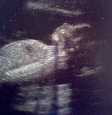 [BabyBoypyle20wks3days[4].jpg]
