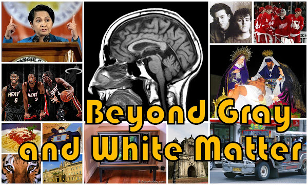 Beyond Gray and White Matter