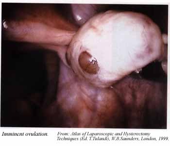 [Lovulation[4].jpg]