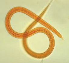 Filariforrn-larvae-Ancylostoma