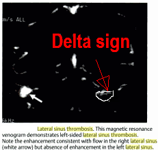 delta sign