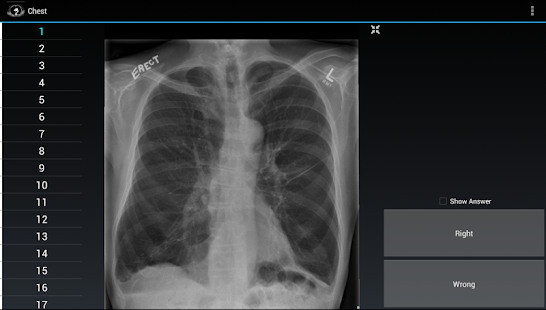 How to mod Radiology Flashcards: Chest lastet apk for pc