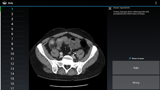 How to get Radiology Flashcards: Body 1.4 mod apk for laptop