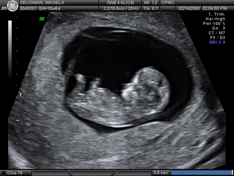 2-14-08 BABY_2.JPG