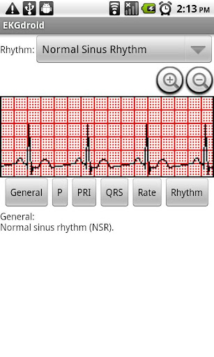EKGdroid