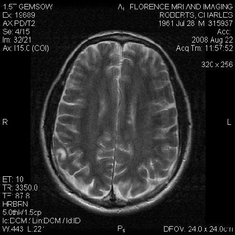 [MRI40019[4].jpg]