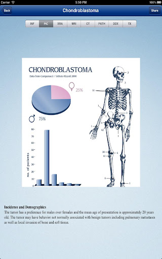 Tumorpedia Soft Tissue