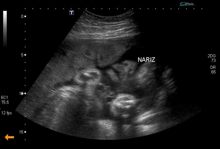 [narizinho da TITIA[3].jpg]