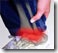 Tendinitis