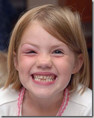 isabelmosquitobiteface