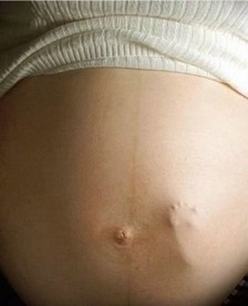 [Stomach and foot[4].jpg]