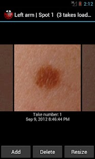 How to install Skin Monitor: check your moles lastet apk for pc