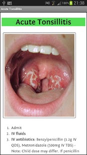 How to download ENT Surgery Handbook 1.0.7 apk for pc