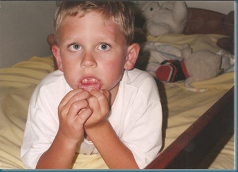Jesse missing tooth