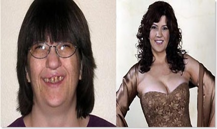 extrememakeover