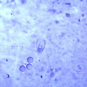 Ciliate and Foraminiferan
