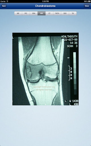 【免費醫療App】Tumorpedia Soft Tissue-APP點子