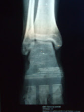 Click to see the bigfooT
