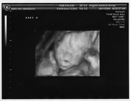 Baby B