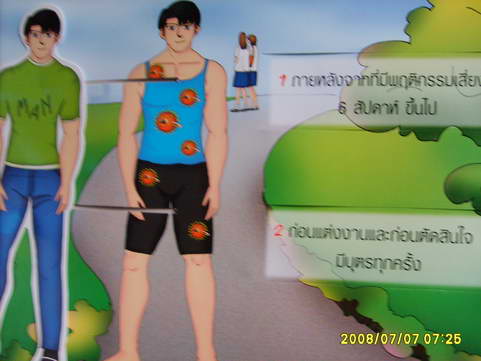 [photo mblog bonkalasin]