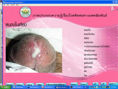 [photo mblog bonkalasin]