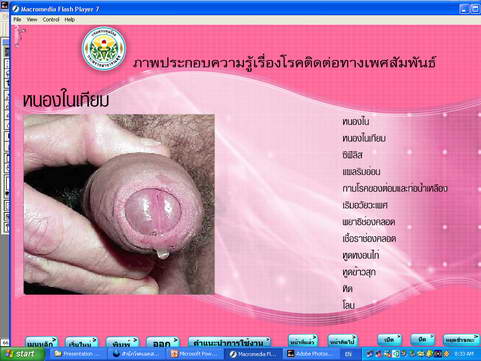 [photo mblog bonkalasin]
