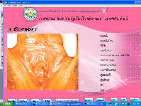 [photo mblog bonkalasin]