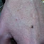 Deer Tick