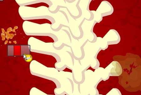 Flash game,模擬類,Amateur Surgeon,Q版外科手術遊戲,開刀,手術遊戲,攻略,影片
