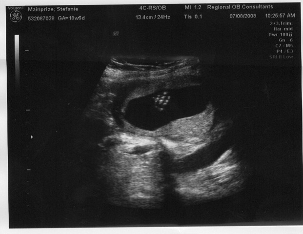 [baby hand[4].jpg]