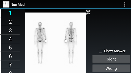 How to install Radiology Flashcards: Nuc Med patch 1.4 apk for bluestacks